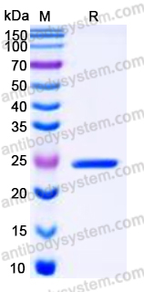 Recombinant Human GSTP1 Protein, Tag free