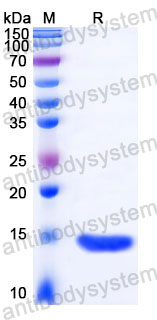 Recombinant Human RBP1 Protein, Tag free