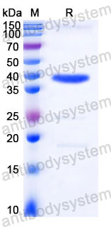 Recombinant Human FBP1 Protein, C-His