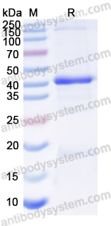 Recombinant Human GNAO1 Protein, N-His