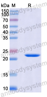 Recombinant Human SNRPA1 Protein, N-His