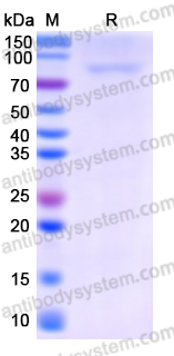 Recombinant Human IFIT2 Protein, N-GST & C-His