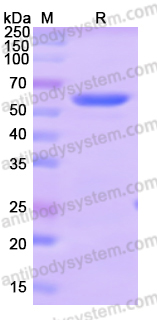 Recombinant Human IFIT1 Protein, N-His