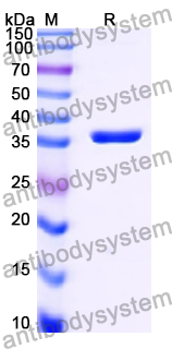 Recombinant Human C4B Protein, N-His