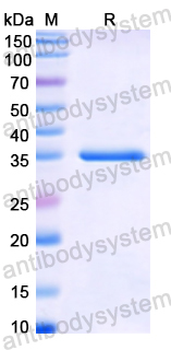 Recombinant Human C1QTNF9 Protein, N-His