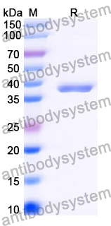 Recombinant Human JMJD7 Protein, N-His