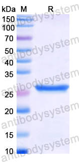 Recombinant Human GSTT2 Protein, N-His