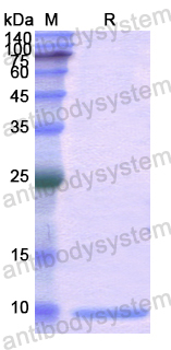 Recombinant Human UBB Protein, N-His