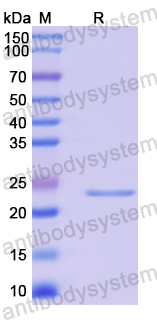 Recombinant Human SAA1 Protein, N-His-SUMO