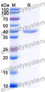 Recombinant Human SAA2 Protein, N-GST & C-His