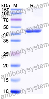 Recombinant Human ZBTB48 Protein, N-His