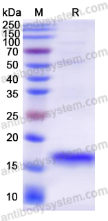 Recombinant Human FDX1 Protein, N-His