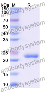 Recombinant Human RAP2A Protein, N-His