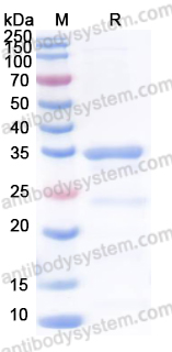 Recombinant Human CCL3/MIP-1-alpha Protein, N-GST & C-His