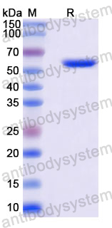 Recombinant Human AR/Androgen receptor Protein, N-His