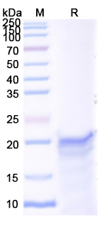 Recombinant Human MAPT/Tau/PHF-tau Protein, N-His