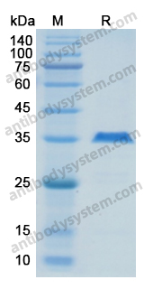 Recombinant Human MAPT/Tau/PHF-tau Protein, N-His