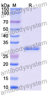 Recombinant Human UROS Protein, N-His
