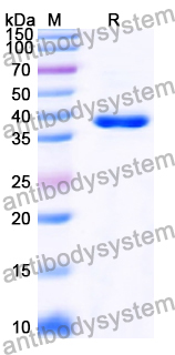 Recombinant Human HAPLN1 Protein, N-His