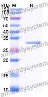 Recombinant Human SLC2A1 Protein, N-His-KSI