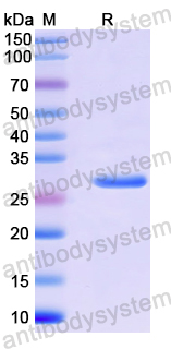 Recombinant Human UMPS Protein, N-His