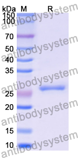 Recombinant Human DBT/BCOADC-E2 Protein, N-His