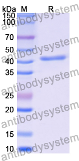 Recombinant Human PYGM Protein, N-His
