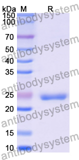 Recombinant Human RALB Protein, N-His
