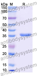 Recombinant Human NAT2 Protein, N-His