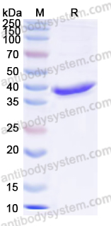 Recombinant Human TOP1 Protein, N-His