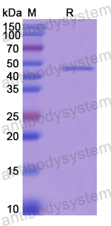 Recombinant Human TOP2A Protein, N-His