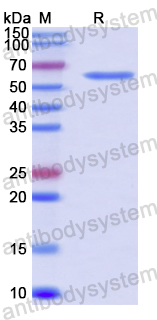 Recombinant Human G6PD Protein, N-His