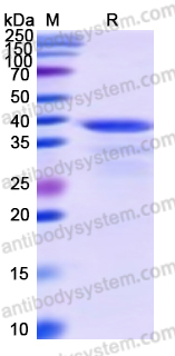 Recombinant Human MTHFD1 Protein, N-His