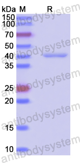Recombinant Human ADH5 Protein, N-His