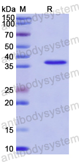 Recombinant Human PRPS2 Protein, N-His