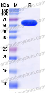 Recombinant Human ODC1 Protein, N-T7 & C-His