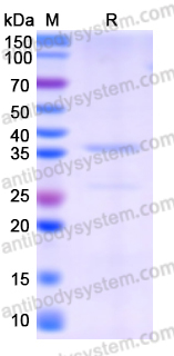 Recombinant Human NEFH Protein, N-GST & C-His