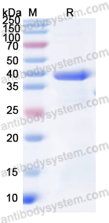 Recombinant Human COL6A2 Protein, N-His
