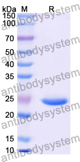 Recombinant Human SLC25A4 Protein, N-His-KSI