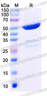 Recombinant Human CKB Protein, N-His