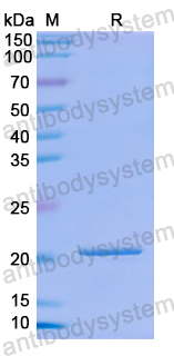 Recombinant Human FCER1A Protein, N-His