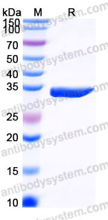 Recombinant Human ANXA3 Protein, Tag free