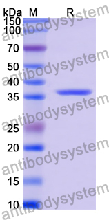 Recombinant Human BCKDHA Protein, N-His