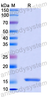 Recombinant Human SKIL Protein, N-His