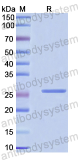Recombinant Human ACTN1 Protein, N-His