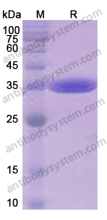 Recombinant Human CD324/CDH1 Protein, N-His