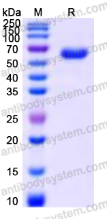 Recombinant Human PEPD Protein, Tag free