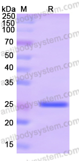Recombinant Human XRCC6 Protein, N-His