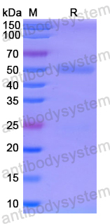 Recombinant Human ALAS1 Protein, N-His