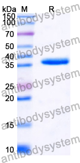 Recombinant Human MYF5 Protein, N-GST & C-His